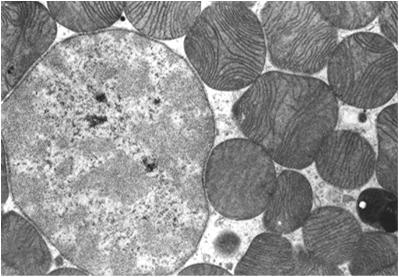 Adipocyt wielopęcherzykowy: mniejsze (20-40 μm) liczne drobne krople