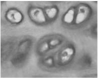 bogata w siarczany chondroityny chondrocyty zlokalizowane w jamkach:
