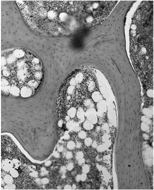 hydrolazowych) trawienie zewnątrzkomórkowe (4) endocytoza nadtrawionych fragmentów trawienie