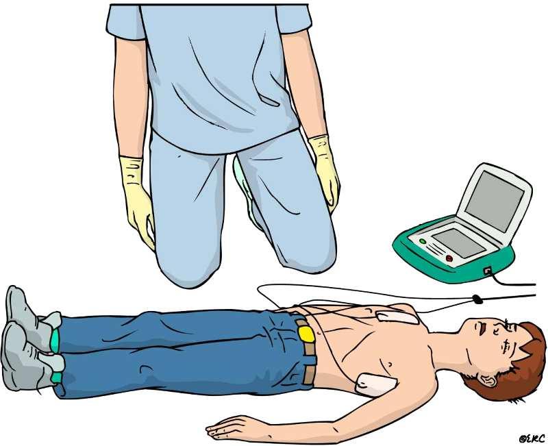 (powyżej 8. roku życia) należy użyć normalnego AED ze standardowymi elektrodami.