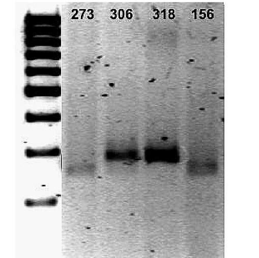 P R A C E O R Y G I N A L N E Ginekol Pol. 2010, 81, 594-599 Polimorfizm genów kodujących MMP-1 oraz MMP-3... Rycina 1.