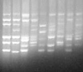 Rybotypowanie Elektroforetyczny rozdział produktów uzyskanych po amplifikacji DNA izolowanego ze szczepów C.