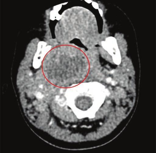 Karolina Raczkowska-Łabuda, Anna Gorzelnik, Jolanta Jadczyszyn, Monika Jabłońska-Jesionowska, Lidia Zawadzka-Głos Fig. 6. Prognosis of the occurrence of the factor Ryc. 6. Prognoza występowania czynnika p 3.