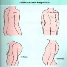 Badanie przedmiotowe narząd ruchu Ocena siły i napięcia mięśniowego (wzmożone lub obniżone), ułożenia ciała, sylwetki, toru chodu.