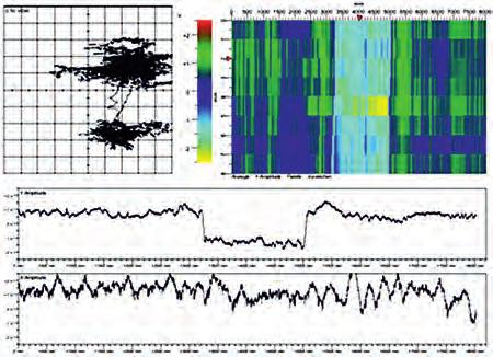30 Badania Nieniszczące i Diagnostyka 3 (2017) It is interesting to discuss the results obtained at a plate with an artificially produced hard spot. The full C-Scan of a test-run is shown in Fig.