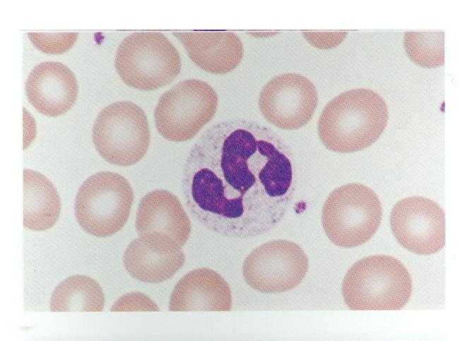 Granulocyt