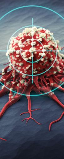 PIELĘGNIARSTWO 15 POWIKŁANIA IMMUNOLOGICZNE ZE STRONY UKŁADU ODDECHOWEGO Immunologiczne zapalenie płuc najczęściej z kaszlem i dusznością, występuję u 1 do 3% pacjentów, w różnym stopniu nasilenia.
