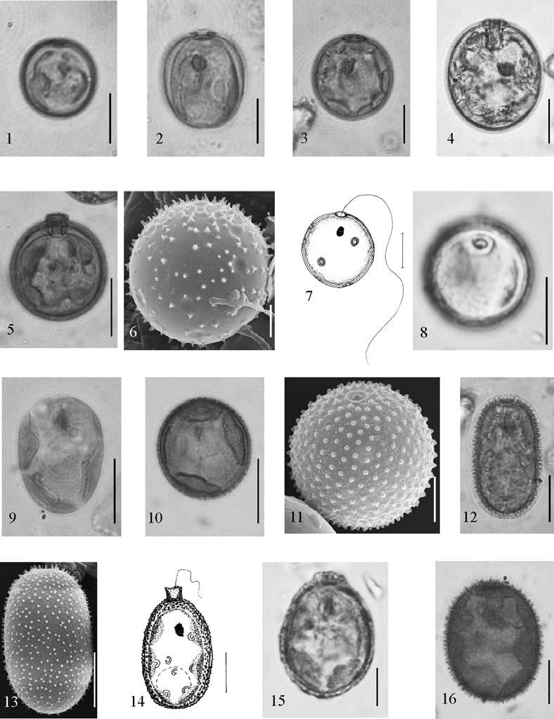 418 Fragm. Flor. Geobot. Polonica 16(2), 2009 Ryc. (Fig.) 1. 1 Trachelomonas volvocina Ehrenberg var. volvocina; 2 T. volvocina var. subglobosa Lemmermann; 3 T. volvocinopsis Swirenko; 4 T.