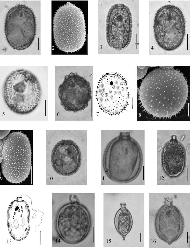 420 Fragm. Flor. Geobot. Polonica 16(2), 2009 Ryc. (Fig.) 2. 1 Trachelomonas hispida var. coronata Lemmermann; 2 T. allia Dreżepolski; 3 T. dreżepolskiana Conrad; 4 T. sydneyensis Playfair var.