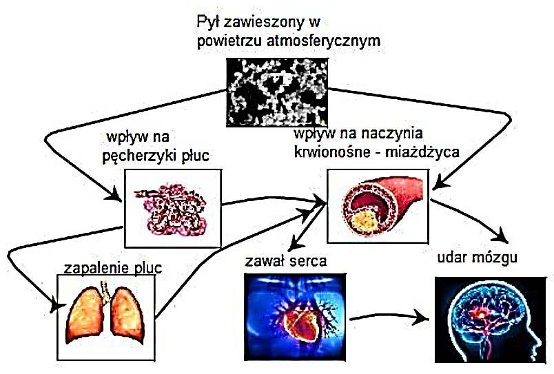 Wpływ cząstek zawieszonych na udary mózgu Zanieczyszczenia powietrza traktowane są, jako istotny czynnik