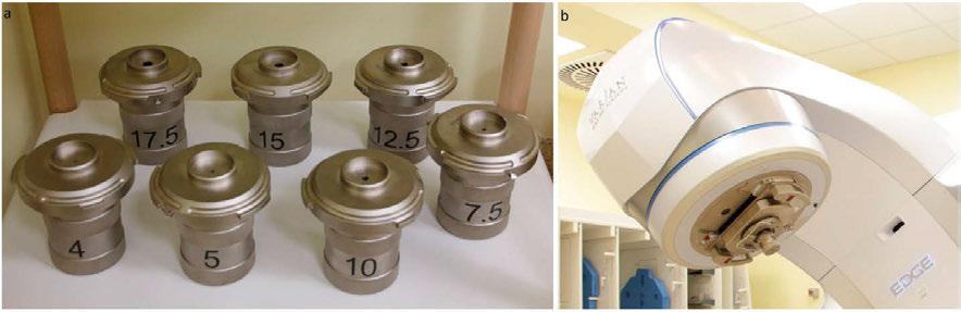 radioterapia \ radiotherapy artykuł naukowy \ scientific paper autorzy [3] również zwracają uwagę na trudności w planowaniu i realizacji leczenia za pomocą kolimatorów stożkowych zmian o