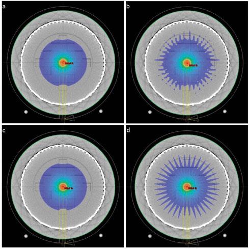 artykuł naukowy / scientific paper radioterapia / radiotherapy (ii).