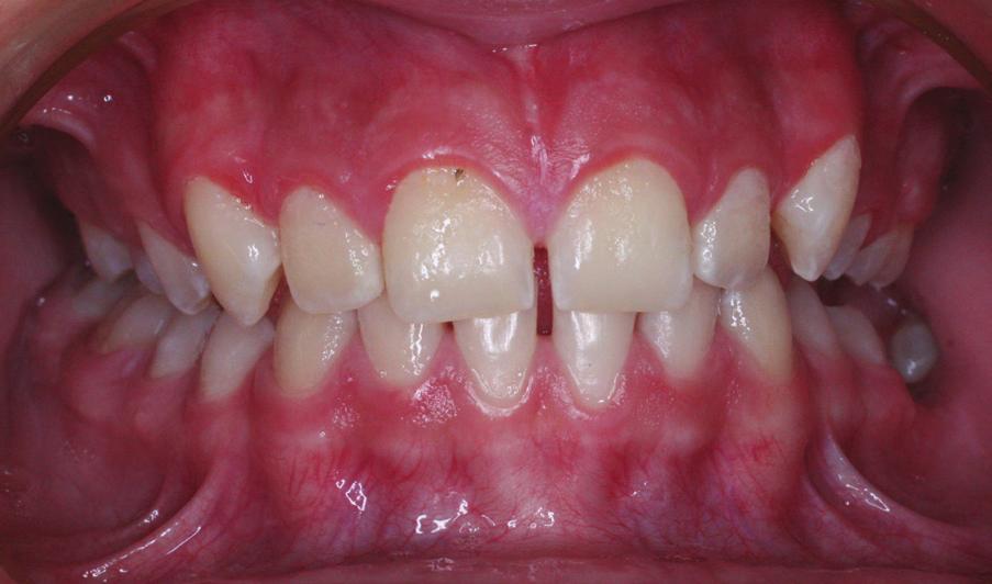 intraoral photographs: c