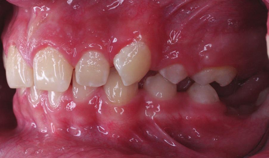 view, e left side, f, g