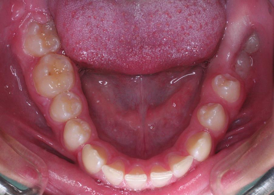 projekcja en face, b