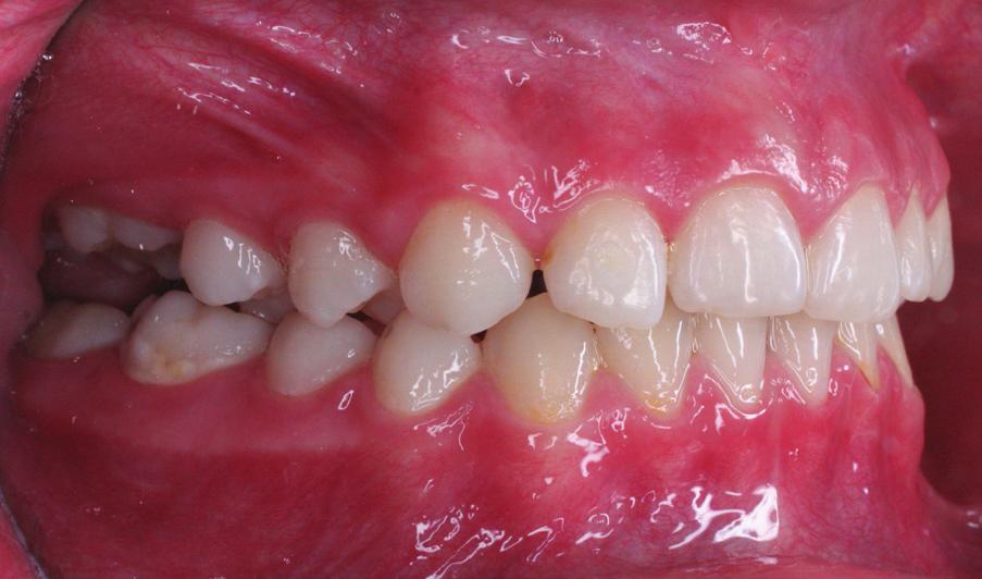 Extraoral photographs: a