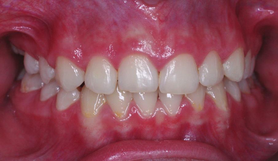 intraoral photographs: c