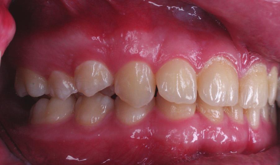 Extraoral photographs: a