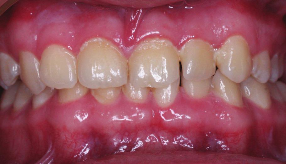 intraoral photographs: c