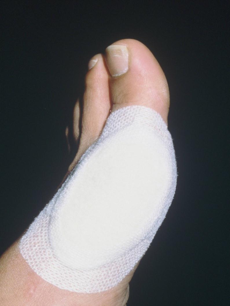 PLASTER UMIESZCZANY NA ZEWNĄTRZ (OKLUZYJNY) Stosowany na zewnętrznej części podkładki.