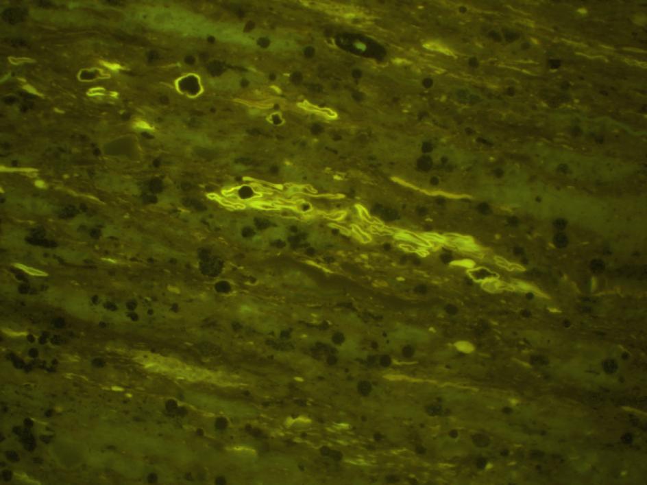 Solid bitumen exhibiting very bright
