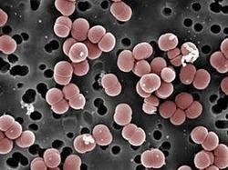 Enterococcus faecium Oporność naturalna na niektóre antybiotyki, Oporność nabyta na wysokie stężenia aminoglikozydów HLAR, Oporność na wankomycynę szczepy VRE
