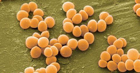 Staphylococcus aureus Gronkowiec złocisty najbardziej chorobotwórczy z gatunku Staphylococcus.