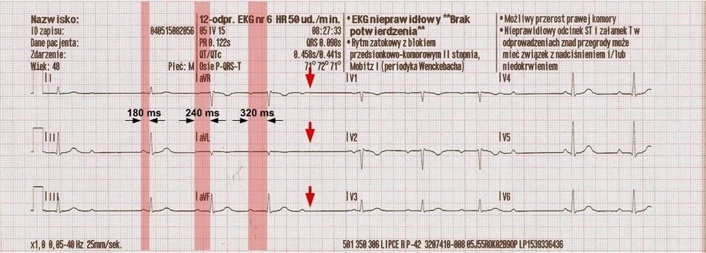 [ryc.5] [http://emergencycardiology.blogspot.