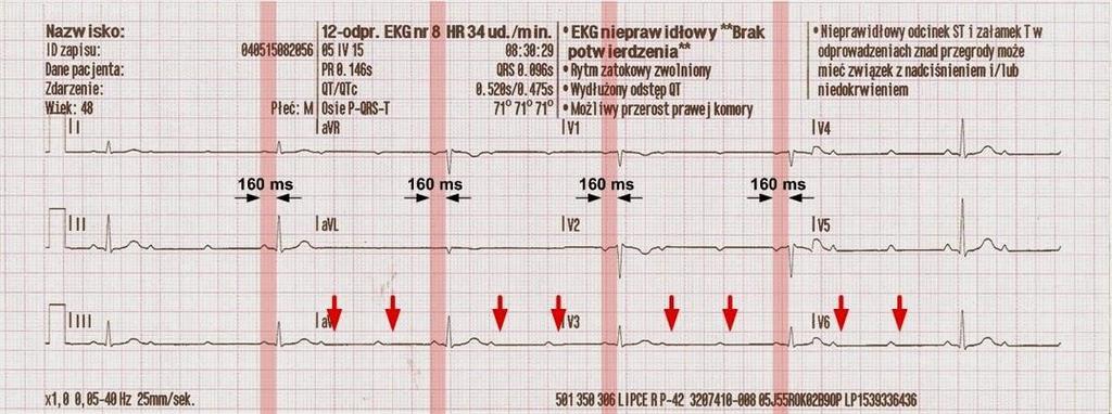 html] [ryc.6] [http://emergencycardiology.