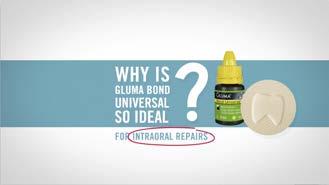 GLUMA Bond Universal!