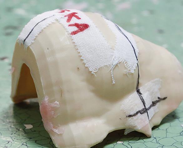 Moje badania Zajmuję się zastosowaniem druku 3D (techniki drukowania przestrzennego, w którym z modelu komputerowego powstaje trójwymiarowy obiekt) w radioterapii, czyli leczeniu chorób nowotworowych