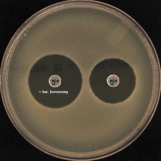 boronowy meropenem 10 μg + kwas boronowy 300 μg 29 mm Na podstawie uzyskanych wyników można wnioskować, że