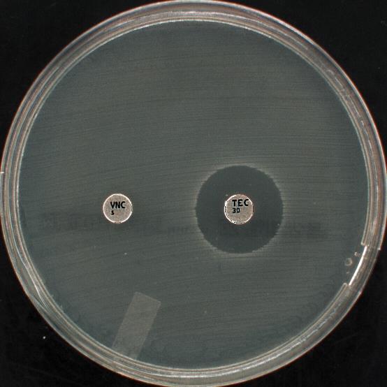 Enterococcus gallinarum PM-269 : Odp. E. prezentuje fenotyp VanC oraz VanA Pytanie 13.