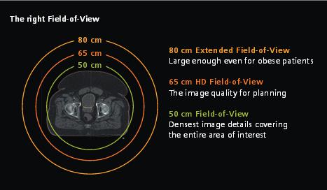 radioterapia \ radiotherapy artykuł naukowy \ scientific paper np. z rękoma nad głową, a to wymaga większej średnicy tunelu.