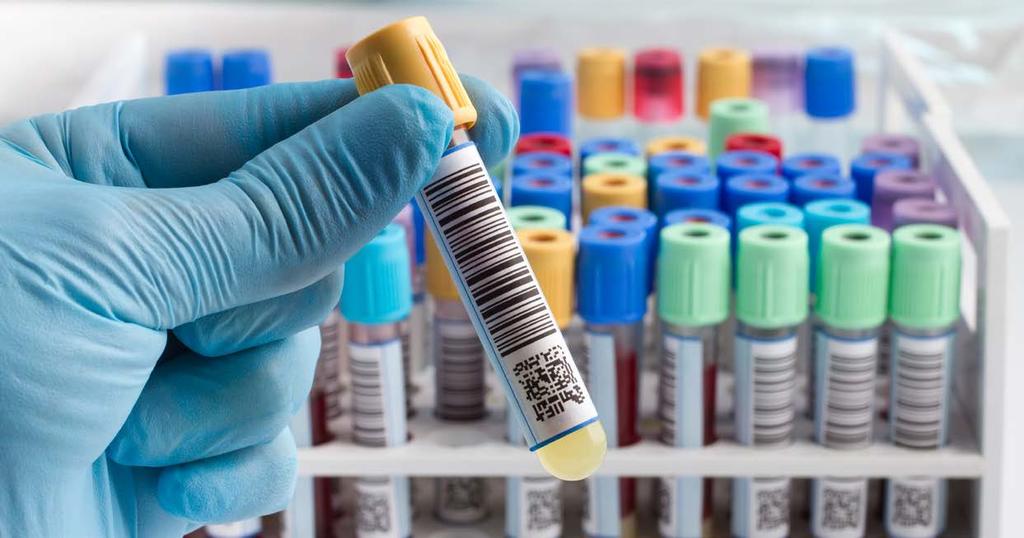RP31L umożliwia wykrywanie braku etykiet za pomocą detektora luminescencyjnego, co jest ogromną zaletą w zastosowaniach, w których konieczne jest zminimalizowanie ryzyka braku etykiety.