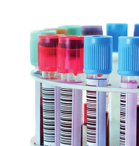 Etykiety na opakowania o niewielkiej średnicy Etykietowanie opakowań o małej średnicy wymaga dokładnie dopracowanego połączenia materiału wierzchniego i