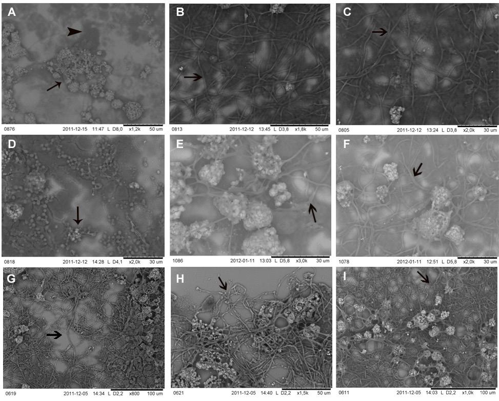 Nr 2-4 Pochodne sulfonowe i sulfanylowe aktywne wobec C. albicans 181 Fig. 1 Inhibition of morphogenesis of C. albicans by new sulfanyl and sulfone derivatives.