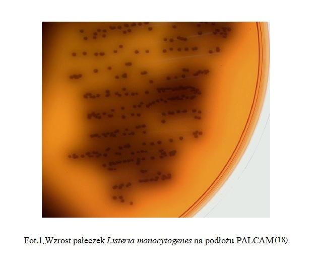 Nr 2-4 Diagnostyka zakażeń L. monocytogenes 195 przeciwciała hamujące wzrost pałeczek Listeria.