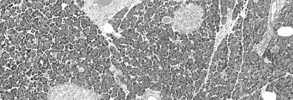 chromochłonnej A, NA chromograniny enkefaliny DBH ATP Enzymy: TH hydroksylaza tyrozyny DDC dekarboksylaza DOPA DBH