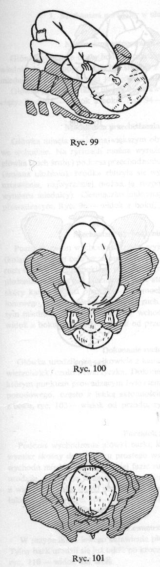 3. Mechanizm