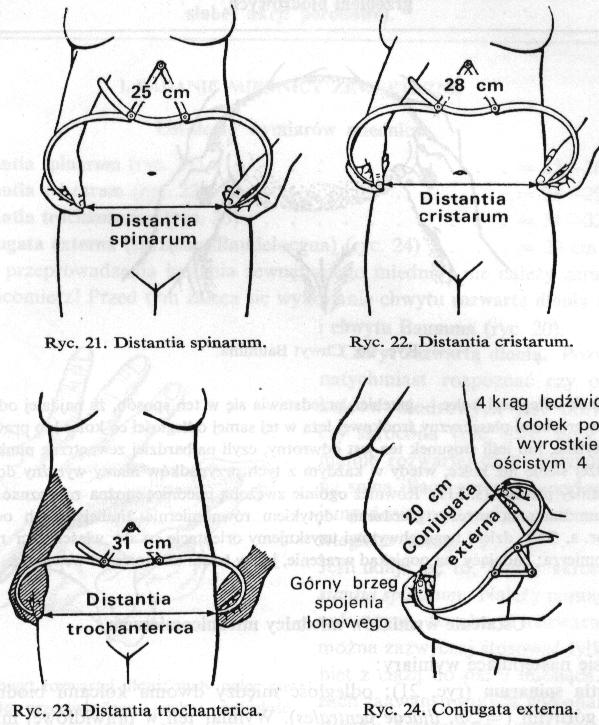 Wymiary zewnętrzne miednicy Wymiar międzykolcowy Wymiar międzygrzebieniowy Wymiar międzykolcowy 25 26 cm Wymiar