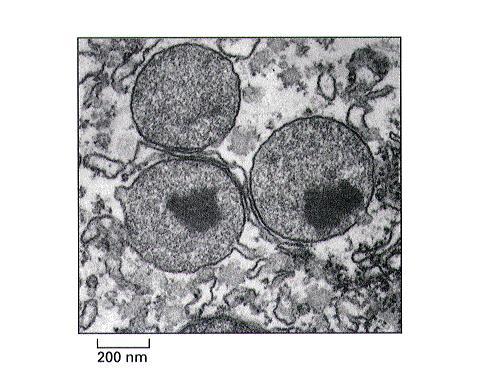 Peroksysomy Peroksysomy - pierwotne utleniacze (mikrociała) w komórkach zwierzęcych i roślinnych biochemiczna zmienność (procesy metaboliczne: kataboliczne i anaboliczne) 0,2 1,8 µm pojedyncza błona
