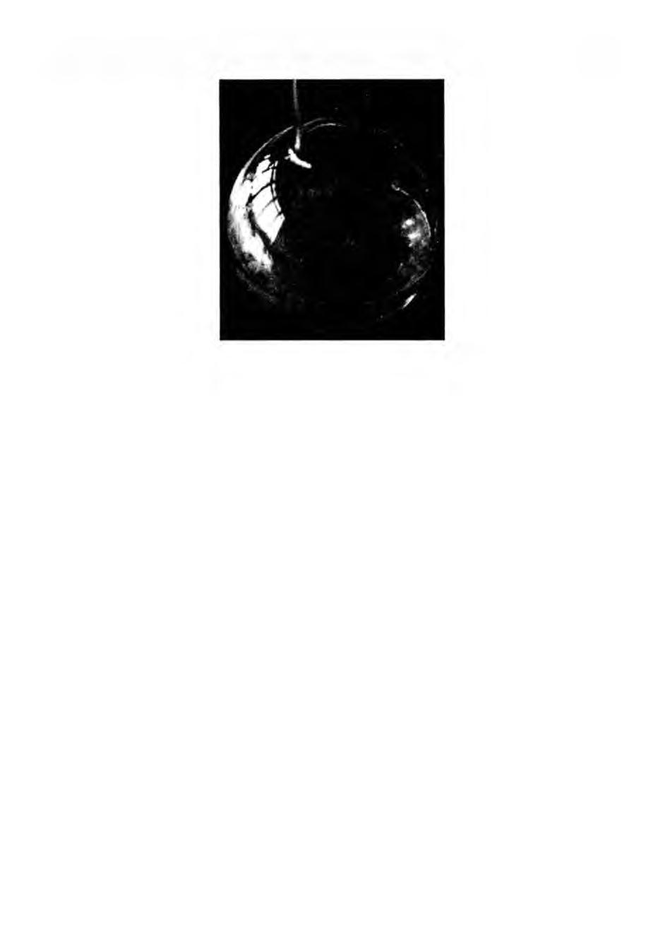 BIOSYNTEZA I MOŻLIWOŚCI WYKORZYSTANIA CELULOZY BAKTERYJNEJ 31 Fot. 4. Fig. 4. Celuloza bakteryjna w formie kuleczek wytworzona w warunkach hodowli wgłębnej.