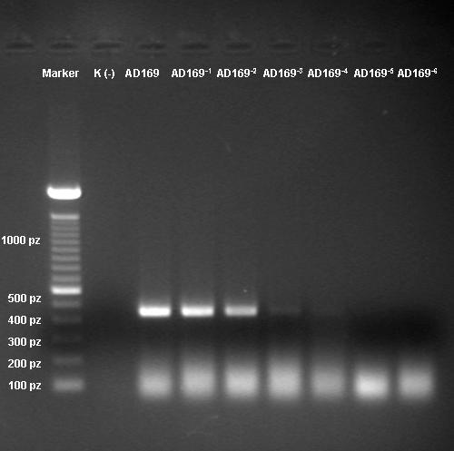 82 Ł. Chabros i inni Nr 1 Ryc.1 Badanie czułości PCR w kierunku wykrywania DNA HHV-5.