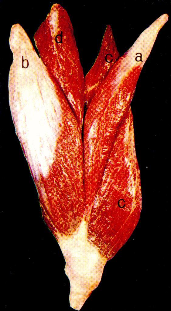 mięsieo czworogłowy uda (preparat) a. m. prosty uda b. m. obszerny boczny c.