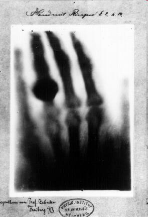 3 X-ray history X-rays were discovered and