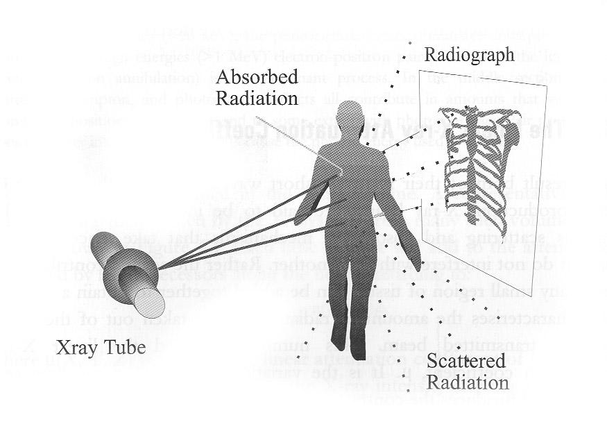 X-ray radiographic geometry 4 Two main