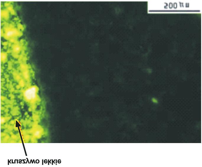 a) b) Rys.8. Zdjêcia w œwietle UV strefy przejœciowej miêdzy zaczynem i normalnym kruszywem (a) oraz zaczynem i nawil onym kruszywem lekkim (b), Laura [32] Fig.