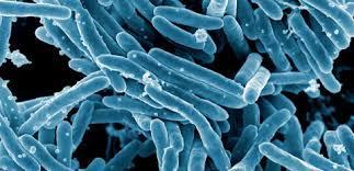 Mycobacterie MOTT Rozpowszechnione w przyrodzie około 150 gat. Gatunki chorobotwórcze dla ludzi 25 gat.