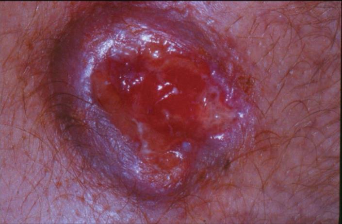 Case Rep Dermatol